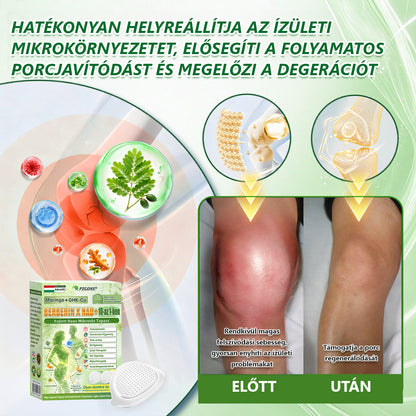Hivatalos márkabolt | PZGONE® Moringa + Berberin × NAD+ 10 az 1-ben nano-mikrotűs tapasz | Napi egyszeri használat | Testsúlykezelés, bőrfeszesség, energiaszint és általános jóllét támogatására