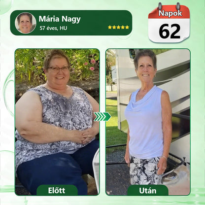 Hivatalos márkabolt | PZGONE® Moringa + Berberin × NAD+ 10 az 1-ben nano-mikrotűs tapasz | Napi egyszeri használat | Testsúlykezelés, bőrfeszesség, energiaszint és általános jóllét támogatására